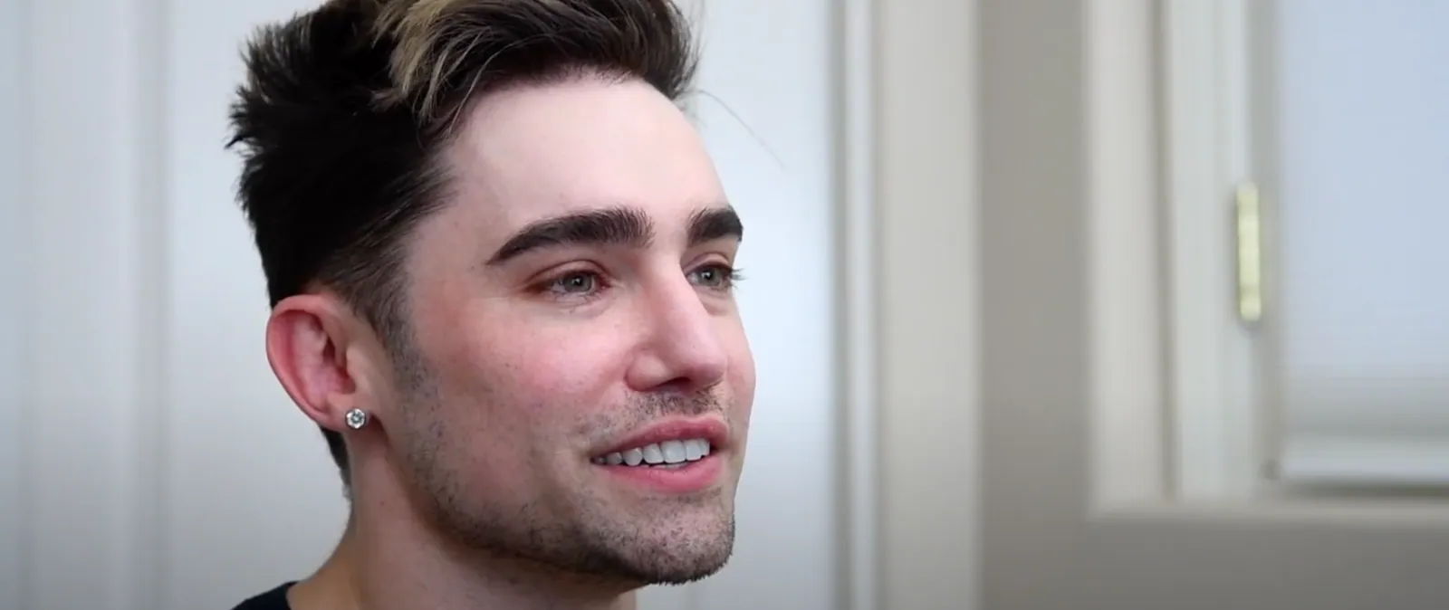 Chad sharing his cosmetic jaw surgery experience
